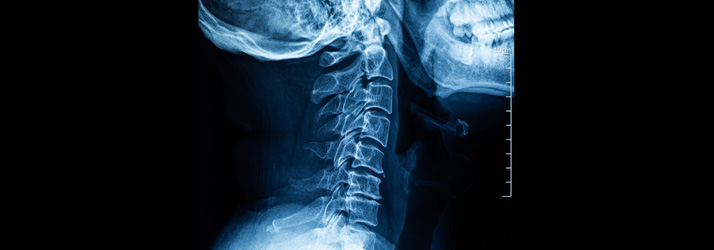 Chiropractic Shelby Twp MI X-Rays